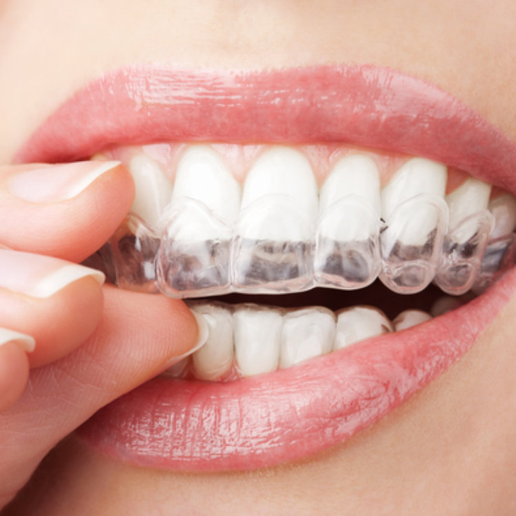 Aesthetic Dental Studio - Dentist- Hamilton, NJ - Invisalign